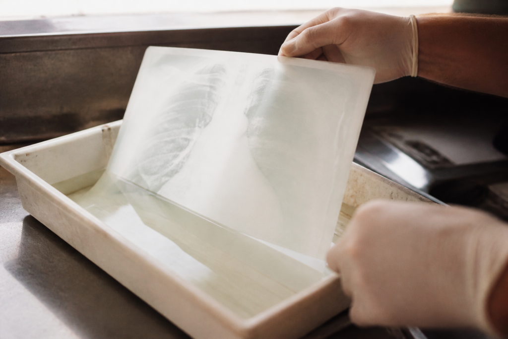 Films radiographiques trempes liquide chimique blanc brillant